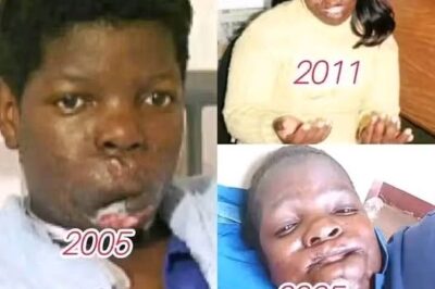 Survivor of a Chilling Ritual Attack in Venda: A Story of Courage and Horror